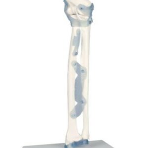 Kyynärpää: nivel ja ligamentit