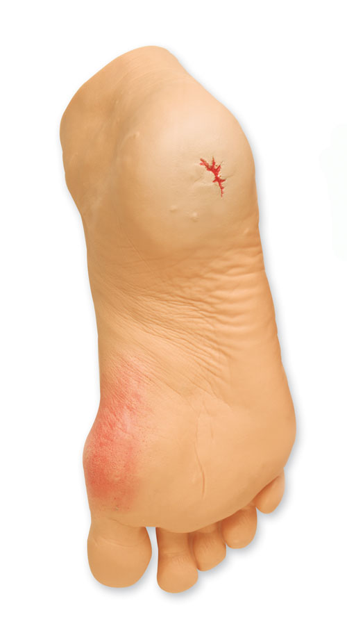 Yleiset jalkaongelmat malli 23 x 9.5 x 11.5 cm