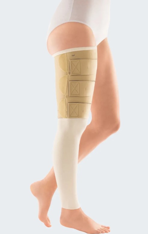 Circaid reduction kit upper leg
